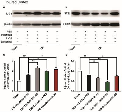 IL-33/ST2L Signaling Provides Neuroprotection Through Inhibiting Autophagy, Endoplasmic Reticulum Stress, and Apoptosis in a Mouse Model of Traumatic Brain Injury